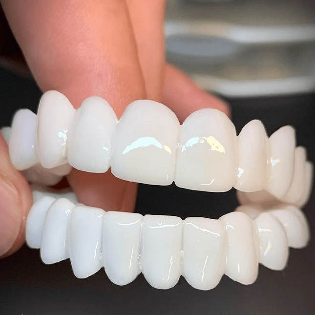 SMILBRO tandprotese med hvide dentallinser set forfra