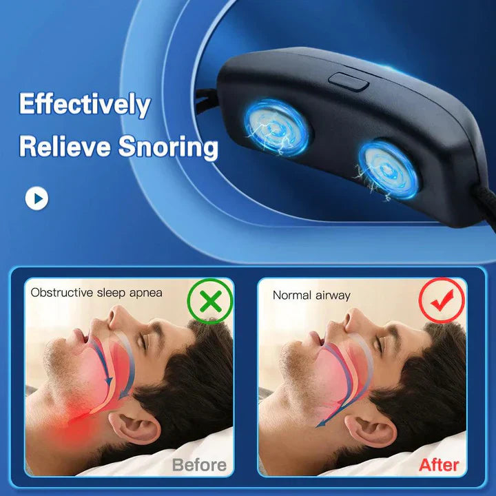 Smart snorkestopper med vibrationspuls og USB-opladning – billede 4